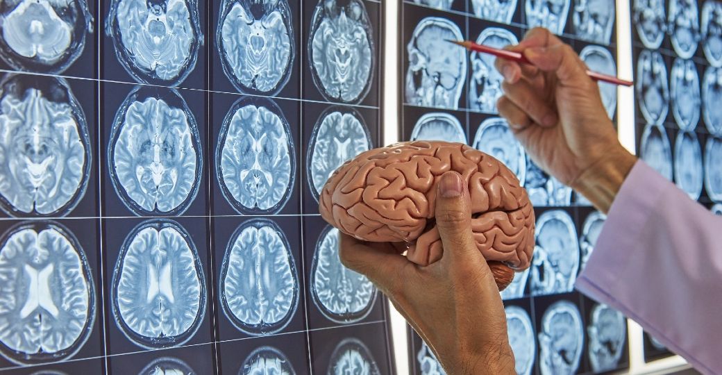 2-Glioblastoma-vacuna